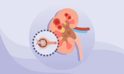 How Does Diuretyk Work? Uses, Effects, and Key Facts